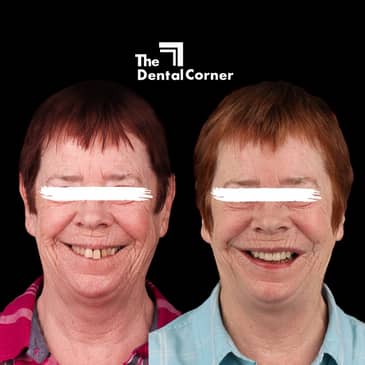 Slider image (7) The Dental Corner